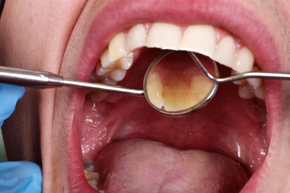Uzm. Dt. Gizem Yurttadur -Konya Ortodonti, Konya Şeffaf Plak Tedavisi, Konya Diş Teli Tedavisi, Konya Invisalign-